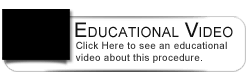 Dental Education Video - Bonded Bridge